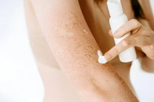 How to Treat Keratosis Pilaris: Best KP Exfoliating Lotions and Skincare Tips
