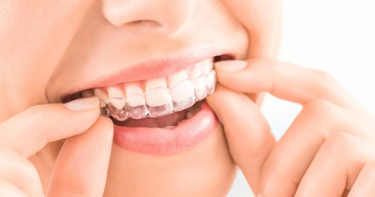 How Invisalign Treatment Helps Richmond Patients Improve Confidence at Any Age